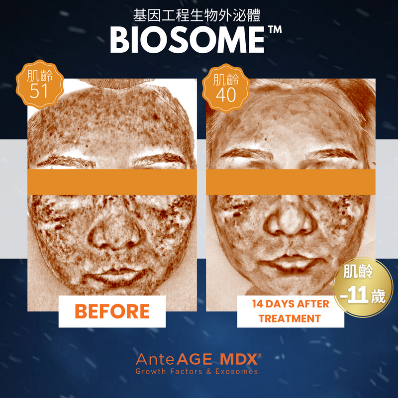 MDX® Biosome Solution