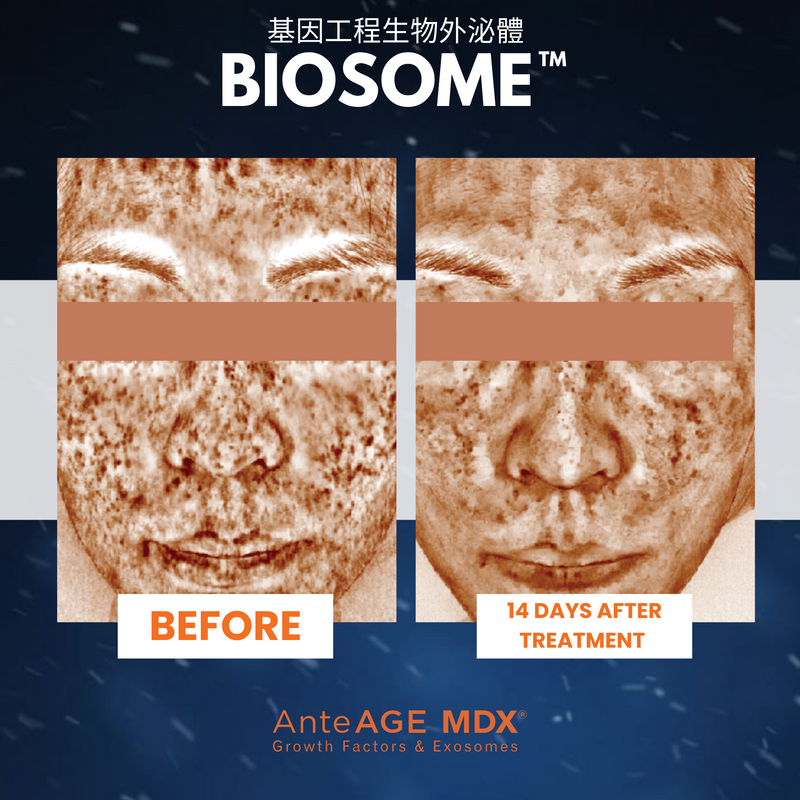 MDX® Biosome Solution